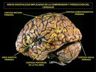 AREAS ENCEFALICAS IMPLICADAS EN LA COMPRENSION Y PRODUCCION DEL
                               LENGUAJE

  CORTEZA MOTORA                                CORTEZA SOMATOSENSITIVA
  PRIMARIA                                             PRIMARIA




                                          W


                   B



AREA AUDITIVA                                             CORTEZA VISUAL
  PRIMARIA                                                   PRIMARIA
                   CORTEZA POSTERIOR
                     DE LA PALABRA
 