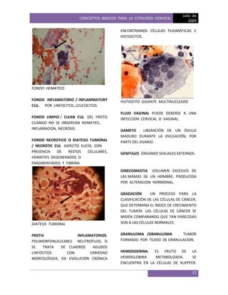 CONCEPTOS BÁSICOS PARA LA CITOLOGÍA CERVICAL
Julio de
2009
17
FONDO HEMATICO
FONDO INFLAMATORIO / INFLAMMATORY
CUL. POR LINFOCITOS, LEUCOCITOS.
FONDO LIMPIO / CLEAN CUL DEL FROTIS
CUANDO NO SE OBSERVAN HEMATIES,
INFLAMACION, NECROSIS.
FONDO NECROTICO O DIATESIS TUMORAL
/ NECROTIC CUL ASPECTO SUCIO, CON
PRESENCIA DE RESTOS CELULARES,
HEMATIES DEGENERADOS O
FRAGMENTADOS Y FIBRINA.
DIATESIS TUMORAL
FROTIS INFLAMATORIOS.
POLIMORFONUCLEARES NEUTROFILOS, SI
SE TRATA DE CUADROS AGUDOS
LINFOCITOS CON VARIEDAD
MORFOLÓGICA, EN EVOLUCIÓN CRÓNICA
ENCONTRAMOS CÉLULAS PLASMÁTICAS E
HISTIOCITOS.
HISTIOCITO GIGANTE MULTINUCLEADO
FLUJO VAGINAL PUEDE DEBERSE A UNA
INFECCION CERVICAL O VAGINAL.
GAMETO LIBERACIÓN DE UN ÓVULO
MADURO DURANTE LA OVULACIÓN, POR
PARTE DEL OVARIO.
GENITALES ÓRGANOS SEXUALES EXTERNOS.
GINECOMASTIA VOLUMEN EXCESIVO DE
LAS MAMAS DE UN HOMBRE, PRODUCIDA
POR ALTERACION HORMONAL.
GRADACIÓN UN PROCESO PARA LA
CLASIFICACIÓN DE LAS CÉLULAS DE CÁNCER,
QUE DETERMINA EL ÍNDICE DE CRECIMIENTO
DEL TUMOR. LAS CÉLULAS DE CÁNCER SE
MIDEN COMPARANDO QUE TAN PARECIDAS
SON A LAS CÉLULAS NORMALES.
GRANULOMA /GRANULOMA TUMOR
FORMADO POR TEJIDO DE GRANULACION.
HEMOSIDERINA: ES FRUTO DE LA
HEMOGLOBINA METABOLIZADA. SE
ENCUENTRA EN LA CÉLULAS DE KUPPFER.
 