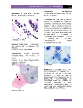 CONCEPTOS BÁSICOS PARA LA CITOLOGÍA CERVICAL
Julio de
2009
7
CARCINOMA IN SITU (CIS) AGENTE
PRECURSOR DEL CANCER INVASOR.
CARCINOMA IN SITU
CARIOLISIS / KARYOLISIS DISOLUCION
DEL NUCLEO DE LA CELULA POR
PERDIDA
GRADUAL DE LA CROMATINA.
CARIOPICNOSIS NUCLEOS RETRAIDOS
HIPERCROMATICOS POR PERDIDA DE
AGUA,
TAMBIEN SE LE LLAMA: CONDENSACION
NUCLEAR. PICNOSIS.
NUCLEO PICNOTICO
CARIORREXIS/ KARYORRHEXIS
DESTRUCCION NUCLEAR/DISOLUCION DEL
NUCLEO PICNOTICO.
CARIORREXIS: EN ESTA ETAPA EL NÚCLEO
AUMENTA SU TAMAÑO, LA CROMATINA
COMIENZA A DISPERSARSE, AGRUPÁNDOSE
ALREDEDOR DE LA MEMBRANA NUCLEAR.
ESTA ÚLTIMA PRESENTA ALGUNAS ZONAS DE
SOLUCIÓN DE CONTINUIDAD (REXIS), POR
LOS CUALES EMPIEZAN A SALIR EL MATERIAL
NUCLEAR HACIA EL CITOPLASMA. LA
CARIORREXIS ES UN FENÓMENO QUE SÓLO
SE OBSERVA EN LA NECROSIS,
CONSIDERÁNDOSE COMO
PATOGNOMÓNICO DE ESTA.
CARIORREXIS
CARIOLISIS: ES LA ÚLTIMA ETAPA Y NO
NECESARIAMENTE ES PROPIA DE LA
NECROSIS, YA QUE ES LA VÍA FINAL
MEDIANTE LA CUAL EL NÚCLEO
DESAPARECE PAULATINAMENTE EN EL
CITOPLASMA, OBSERVÁNDOSE EN
OCASIONES COMO UNA ESPECIE DE
FANTASMA NUCLEAR, O BIEN
SIMPLEMENTE DESAPARECIENDO. ES
PARTE TANTO DE LA NECROSIS COMO
DE LA AUTÓLISIS CADAVÉRICA.
 