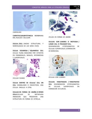 CONCEPTOS BÁSICOS PARA LA CITOLOGÍA CERVICAL
Julio de
2009
8
CARIOLISIS
CARIOTECA/KARYOTHECA MEMBRANA
DEL NUCLEO CELULAR.
CELULA /CELL UNIDAD ESTRUCTURAL Y
MORFOLOGICA DE LOS SERES VIVOS.
CELULA ESCAMOSA / SQUAMOUS CELL
CELULA PLANA. MADURAN POR ESTRATOS
EN PARABASALES, BASALES, INTERMEDIAS
Y SUPERFICIALES.
CELULAS PLANAS
CELULA DENTRO DE CELULA/ CELL ON
CELL CANIBALISMO O FAGOCITOSIS. UNA
CELULA ENGULLE A OTRA.
CELULAS EN FORMA DE ARAÑA O SPIDER
CELLS.CELULAS DE METAPLASIA
INMADURA QUE PRESENTAN UNA
ESTRUCTURA EN FORMA DE ESTRELLA.
CELUAS EN FORMA DE ARAÑA
CELULAS CON LUNARES O MOTEADA /
LUNAR CELL O POLKADOT CELL.
DEGENERACION CITOPLASMATICA DE
CELULAS SUPERFICIALES. (FORMACION
DE MANCHAS).
CELULAS CON LUNARES
CELULAS FENESTRADAS / FENESTRATED
CELL DEGENERACION CITOPLASMATICA
DE CELULAS SUPERFICIALES EN
FORMACION DE SURCOS.
 