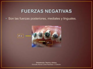 • Son las fuerzas posteriores, mediales y linguales.




         F+

                                        F-




                        Ortodoncia: Teoría y clínica.
                   Gonzalo Alonso Uribe Restrepo. 2 Edición.
 