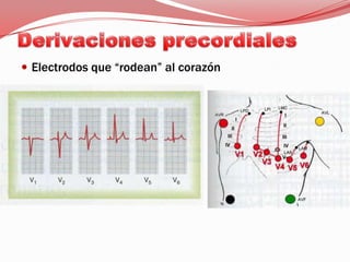 Derivaciones precordialesElectrodos que “rodean” al corazón