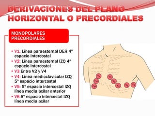 DERIVACIONES DEL PLANO HORIZONTAL O PRECORDIALES