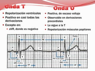 Q, R, S: > 5 mmq, r, s: < 5 mmOndas extra Q’ R’ S’