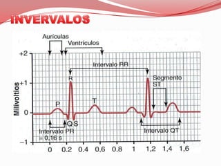 Observable en derivaciones precordiales