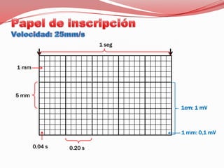 Papel de inscripciónVelocidad: 25mm/s1 seg1 mm5 mm1cm: 1 mV1 mm: 0,1 mV0.04 s0.20 s