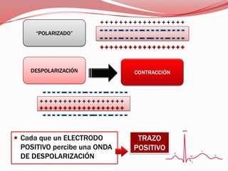 + + + + + + + + + + + + + + + + + + “POLARIZADO”- - - - -- - - - -- - - - -- - - - -- - - - -- - - - -- --- - - -- - - -+ + + + + + + + + + + + + + + + + + DESPOLARIZACIÓNCONTRACCIÓN- - - - -- - - - -- - - - -- - - - -- - - - -- - - - -- --- - - -- - - -+ + + + + + + + + + + + + + + + + + + + + + + + + + + + + + + + + + + + Cada que un ELECTRODO POSITIVO percibe una ONDA DE DESPOLARIZACIÓN TRAZO POSITIVO