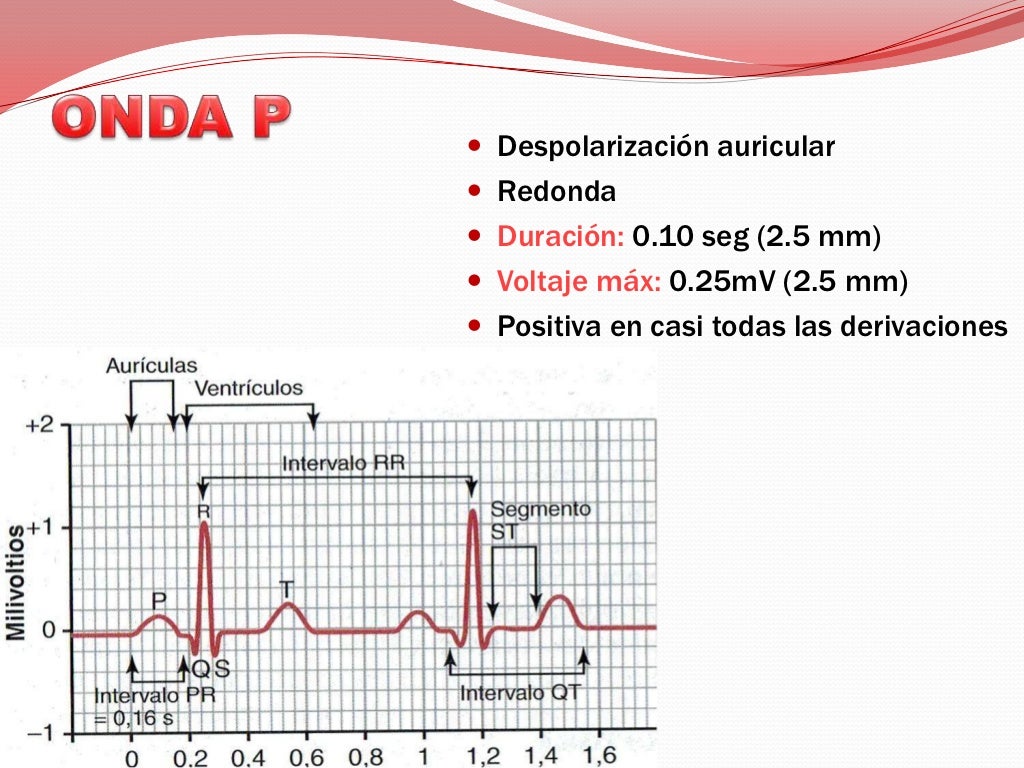Como Saber Si Un Electrocardiograma Esta Bien pt.slideshare.net