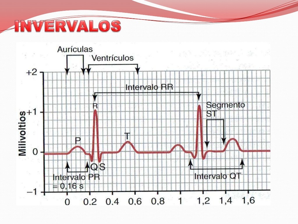 Interpretacion electrocardiograma EKG