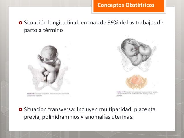 Conceptos obstétricos (Situación, presentación, actitud de posición