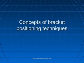 Concepts of bracketConcepts of bracket
positioning techniquespositioning techniques
www.indiandentalacademy.comwww.indiandentalacademy.com
 