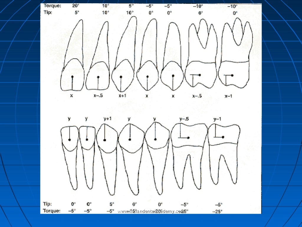 Concepts of orthodontic bracket positioning techniques / fixed orthod…