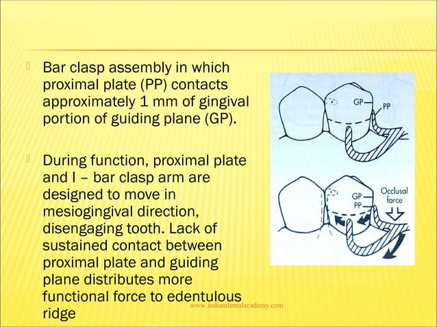 Concepts of rpi/ dentistry dental implants | PPT