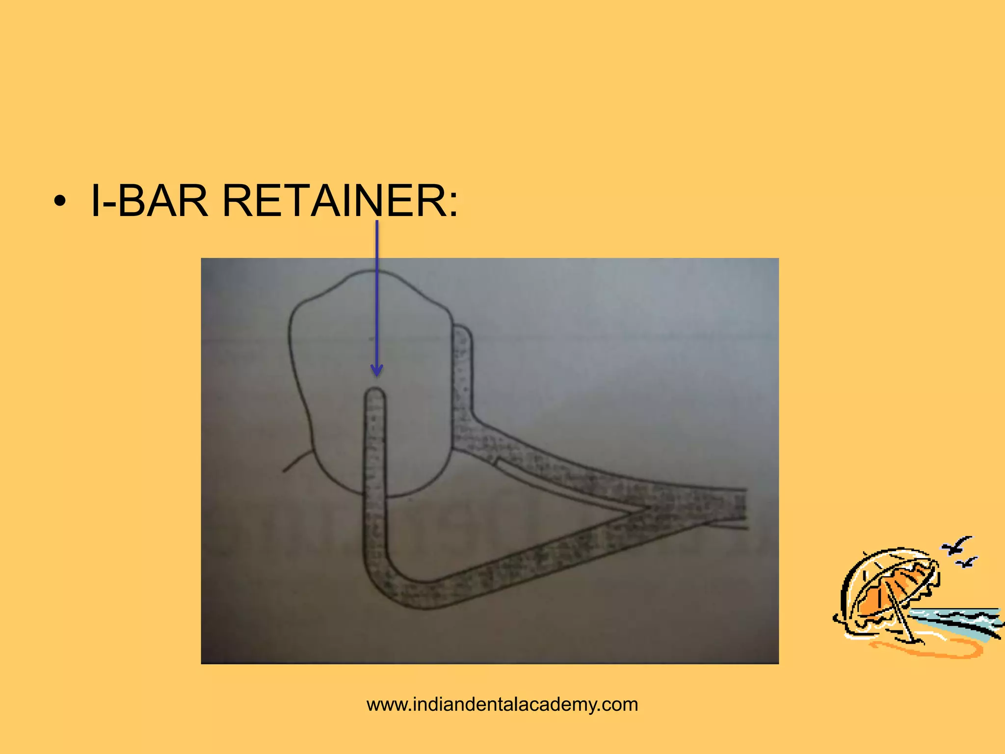 • I-BAR RETAINER:
www.indiandentalacademy.com
 