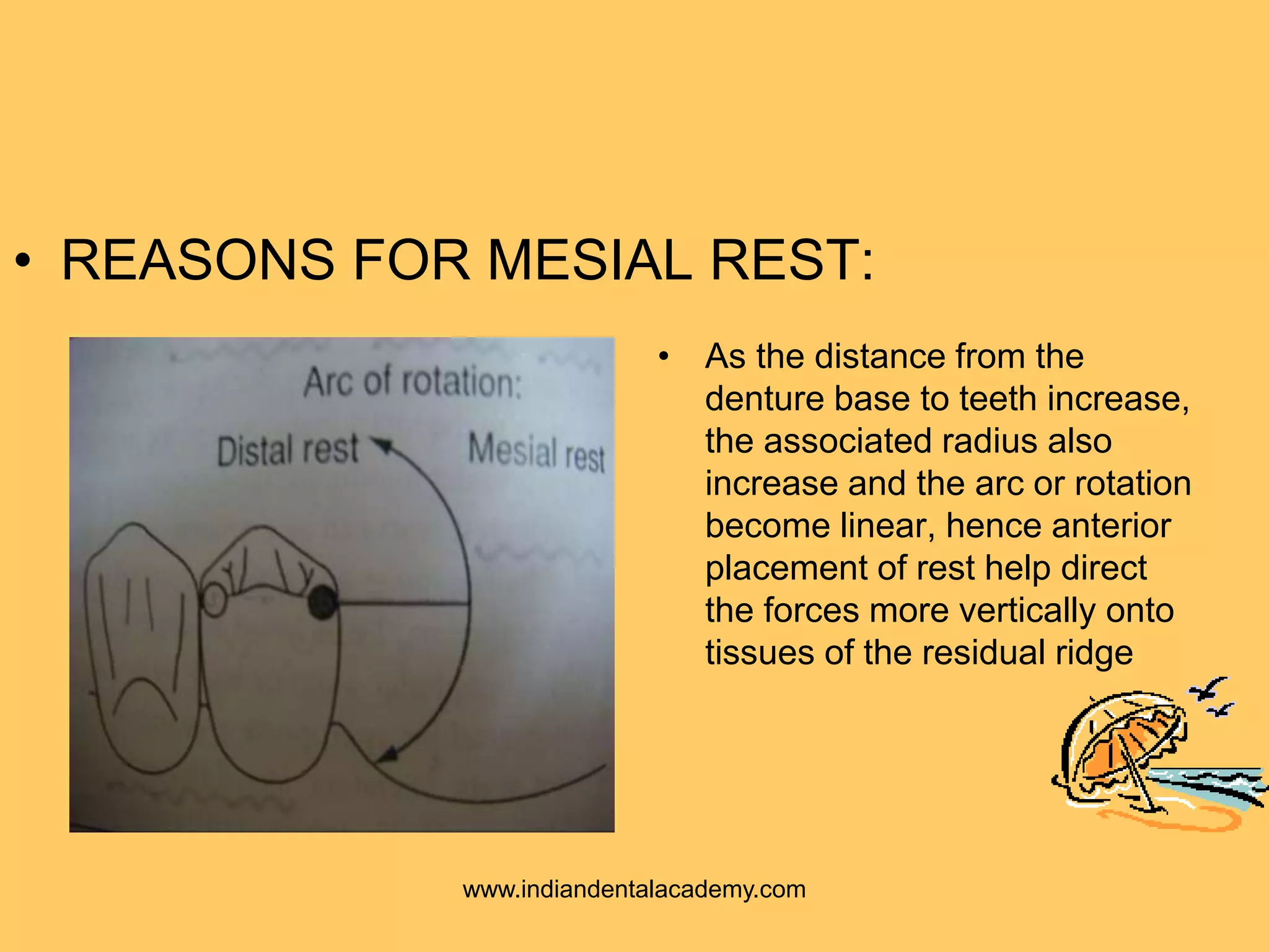 • As the distance from the
denture base to teeth increase,
the associated radius also
increase and the arc or rotation
become linear, hence anterior
placement of rest help direct
the forces more vertically onto
tissues of the residual ridge
• REASONS FOR MESIAL REST:
www.indiandentalacademy.com
 