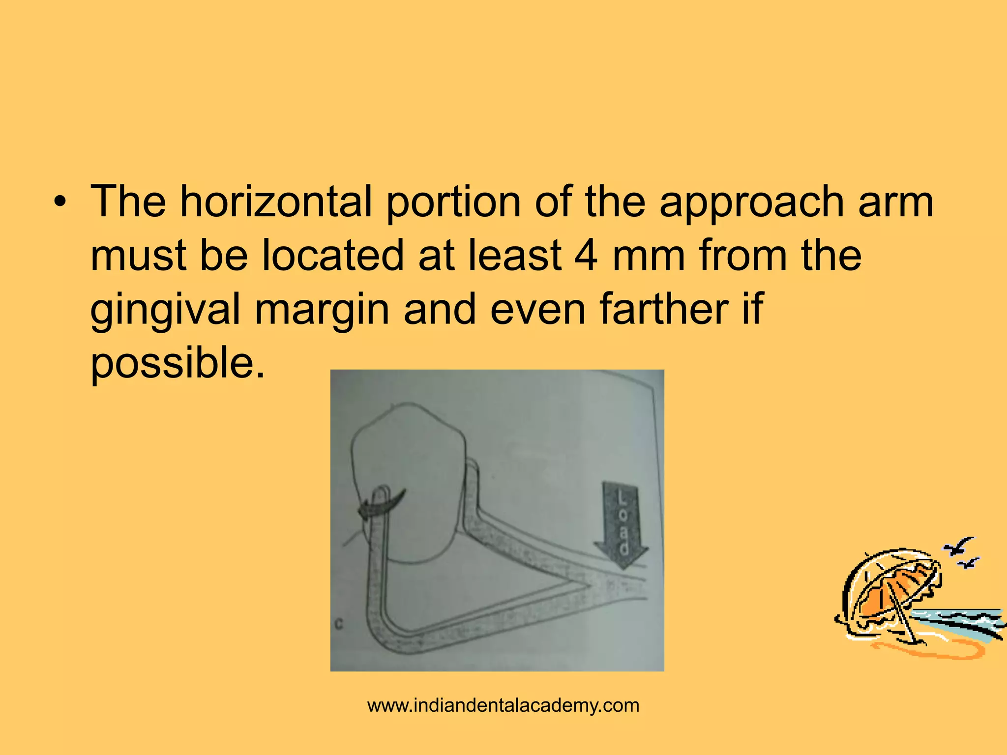 • The horizontal portion of the approach arm
must be located at least 4 mm from the
gingival margin and even farther if
possible.
www.indiandentalacademy.com
 