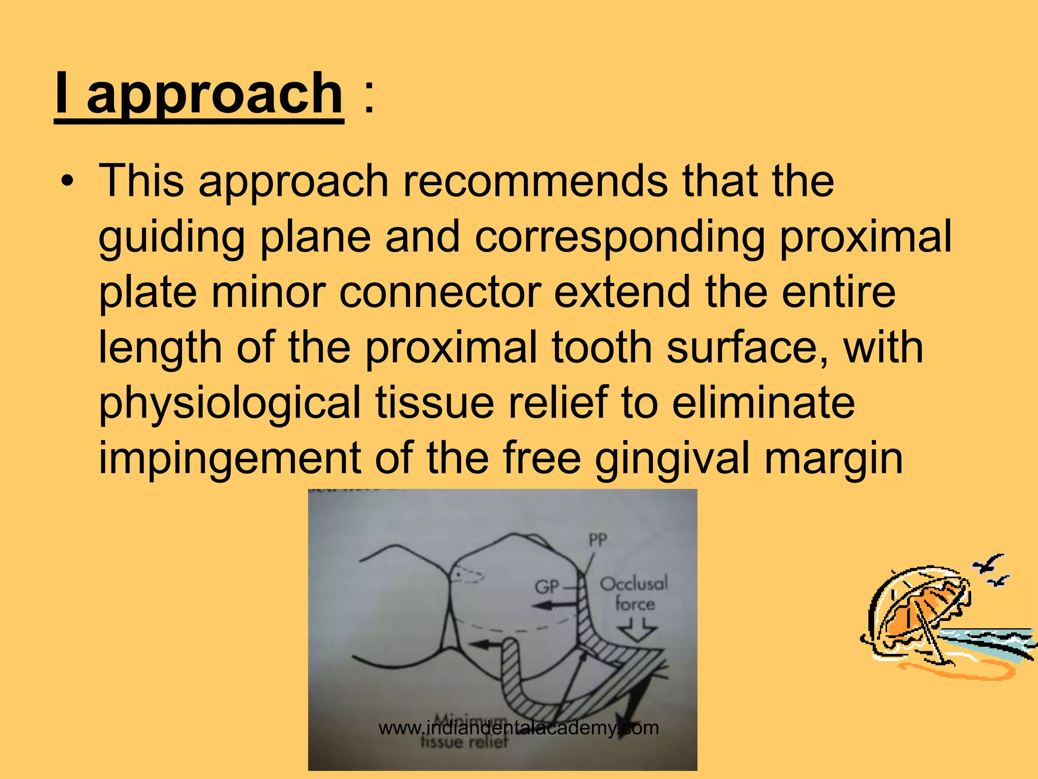 I approach :
• This approach recommends that the
guiding plane and corresponding proximal
plate minor connector extend the entire
length of the proximal tooth surface, with
physiological tissue relief to eliminate
impingement of the free gingival margin
www.indiandentalacademy.com
 