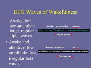 EEG Waves of Wakefulness
• Awake, but
non-attentive:
large, regular
alpha waves
1 second
Alpha waves
Awake, nonattentive
1 second
Beta waves
Awake, attentive
• Awake and
attentive: low
amplitude, fast,
irregular beta
waves
 