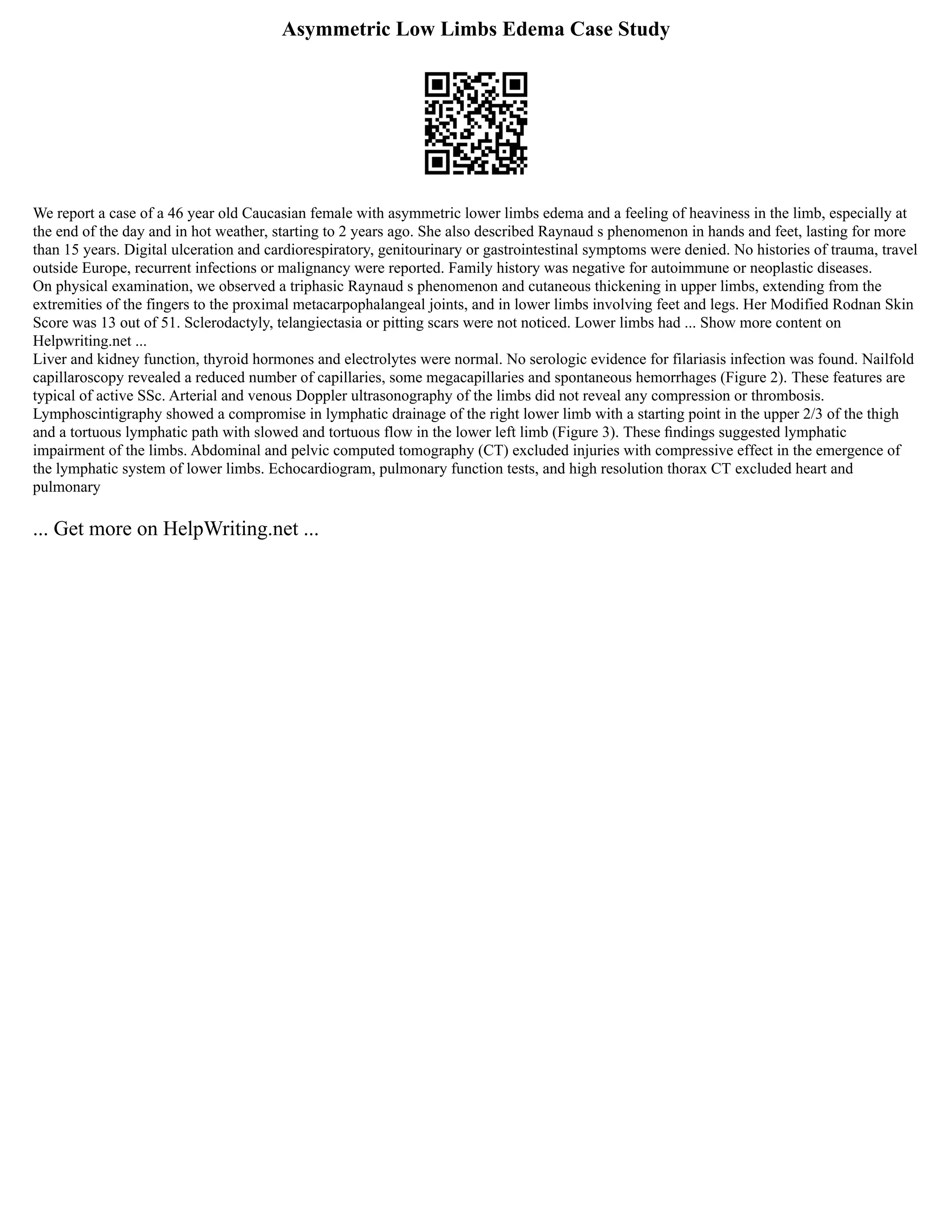 Asymmetric Low Limbs Edema Case Study
We report a case of a 46 year old Caucasian female with asymmetric lower limbs edema and a feeling of heaviness in the limb, especially at
the end of the day and in hot weather, starting to 2 years ago. She also described Raynaud s phenomenon in hands and feet, lasting for more
than 15 years. Digital ulceration and cardiorespiratory, genitourinary or gastrointestinal symptoms were denied. No histories of trauma, travel
outside Europe, recurrent infections or malignancy were reported. Family history was negative for autoimmune or neoplastic diseases.
On physical examination, we observed a triphasic Raynaud s phenomenon and cutaneous thickening in upper limbs, extending from the
extremities of the fingers to the proximal metacarpophalangeal joints, and in lower limbs involving feet and legs. Her Modified Rodnan Skin
Score was 13 out of 51. Sclerodactyly, telangiectasia or pitting scars were not noticed. Lower limbs had ... Show more content on
Helpwriting.net ...
Liver and kidney function, thyroid hormones and electrolytes were normal. No serologic evidence for filariasis infection was found. Nailfold
capillaroscopy revealed a reduced number of capillaries, some megacapillaries and spontaneous hemorrhages (Figure 2). These features are
typical of active SSc. Arterial and venous Doppler ultrasonography of the limbs did not reveal any compression or thrombosis.
Lymphoscintigraphy showed a compromise in lymphatic drainage of the right lower limb with a starting point in the upper 2/3 of the thigh
and a tortuous lymphatic path with slowed and tortuous flow in the lower left limb (Figure 3). These ﬁndings suggested lymphatic
impairment of the limbs. Abdominal and pelvic computed tomography (CT) excluded injuries with compressive effect in the emergence of
the lymphatic system of lower limbs. Echocardiogram, pulmonary function tests, and high resolution thorax CT excluded heart and
pulmonary
... Get more on HelpWriting.net ...
 