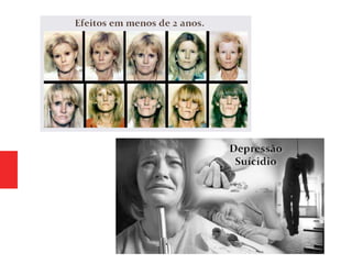 Psiquiatria - Conclusão drogas