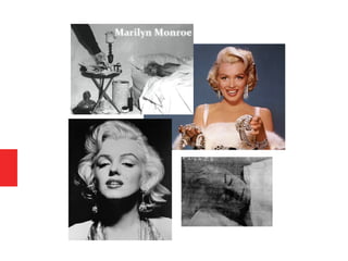 Psiquiatria - Conclusão drogas