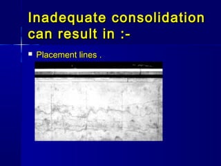 Inadequate consolidationInadequate consolidation
can result in :-can result in :-
 Placement linesPlacement lines ..
 