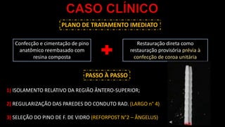 PLANO DE TRATAMENTO IMEDIATO
Confecção e cimentação de pino
anatômico reembasado com
resina composta
Restauração direta como
restauração provisória prévia à
confecção de coroa unitária
1) ISOLAMENTO RELATIVO DA REGIÃO ÂNTERO-SUPERIOR;
2) REGULARIZAÇÃO DAS PAREDES DO CONDUTO RAD. (LARGO n° 4)
3) SELEÇÃO DO PINO DE F. DE VIDRO (REFORPOST N°2 – ÂNGELUS)
PASSO À PASSO
 