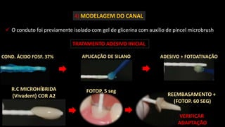 4) MODELAGEM DO CANAL
 O conduto foi previamente isolado com gel de glicerina com auxílio de pincel microbrush
TRATAMENTO ADESIVO INICIAL
COND. ÁCIDO FOSF. 37% APLICAÇÃO DE SILANO ADESIVO + FOTOATIVAÇÃO
R.C MICROHÍBRIDA
(Vivadent) COR A2
FOTOP. 5 seg
REEMBASAMENTO +
(FOTOP. 60 SEG)
VERIFICAR
ADAPTAÇÃO
 