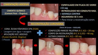 CIMENTO QUÍMICO
(Cement Post – Ângelus)
7) CIMENTAÇÃO ADESIVA  ESPATULADO EM PLACA DE VIDRO
=15 seg
 INTRODUZIDO NO CONDUTO RAD.
= SERINGA CENTRIX
 AGUARDOU-SE 5 min
= Para iniciar a reconstrução coron.
8) RECONSTRUÇÃO CORONÁRIA
 COND. ÁCIDO FÓSFORICO 37% (FGM)
- Lavagem com água + secagem
 APLICAÇÃO SIST. ADESIVO
- (Fusion Duralink- Ângelus)
- 3 Passos
 CONFECÇÃO PAREDE PALATINA (R.C A2) – 20 seg
 CORPO DA RESTAURAÇÃO (R.C A 3,5D) – 40 seg
 ULTIMA CAMADA (R.C A2) – 60 seg
(Tetric N Ceram – IVOCLAR)
 