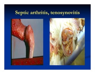 Septic arthritis, tenosynovitisSeptic arthritis, tenosynovitisSeptic arthritis, tenosynovitisSeptic arthritis, tenosynovitis
 