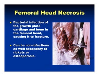 Femoral Head NecrosisFemoral Head NecrosisFemoral Head NecrosisFemoral Head Necrosis
Bacterial infection ofBacterial infection of
the growth platethe growth plate
cartilage and bone incartilage and bone in
the femoral headthe femoral headthe femoral head,the femoral head,
causing it to fracture.causing it to fracture.
Can be nonCan be non--infectiousinfectious
as well secondary toas well secondary to
rickets orrickets orrickets orrickets or
osteoporosis.osteoporosis.
 