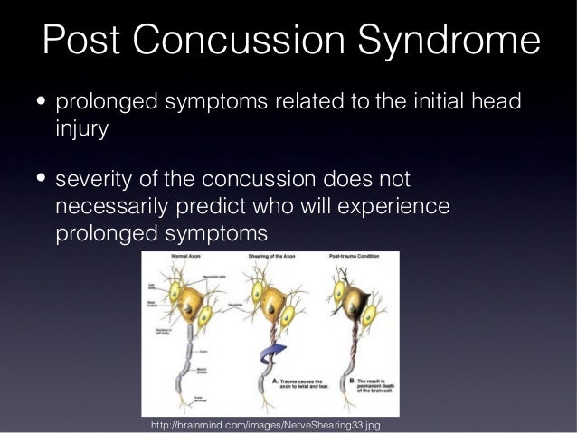 impulsive force concussion image impulsive force concussion image