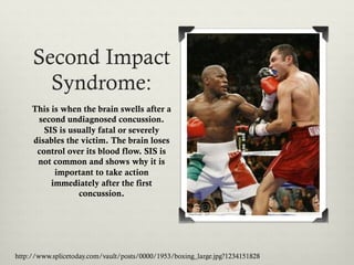 Second Impact
       Syndrome:
     This is when the brain swells after a
      second undiagnosed concussion.
        SIS is usually fatal or severely
     disables the victim. The brain loses
      control over its blood flow. SIS is
      not common and shows why it is
           important to take action
          immediately after the first
                 concussion.




http://www.splicetoday.com/vault/posts/0000/1953/boxing_large.jpg?1234151828
 