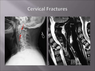 Head and Neck Injuries in Sports: A Sports Medicine Physician's ...