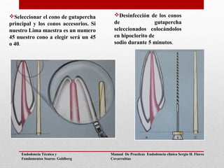 Seleccionar el cono de gutapercha
principal y los conos accesorios. Si
nuestro Lima maestra es un numero
45 nuestro cono a elegir será un 45
o 40.
Desinfección de los conos
de gutapercha
seleccionados colocándolos
en hipoclorito de
sodio durante 5 minutos.
Manual De Practicas Endodoncia clínica Sergio H. Flores
Covarrubias
Endodoncia Técnica y
Fundamentos Soares- Goldberg
 