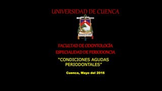 UNIVERSIDAD DE CUENCA
FACULTADDE ODONTOLOGÍA
ESPECIALIDADDE PERIODONCIA
“CONDICIONES AGUDAS
PERIODONTALES”
Cuenca, Mayo del 2016
 