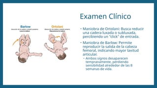 Examen Clínico
• Maniobra de Ortolani: Busca reducir
una cadera luxada o subluxada,
percibiendo un "click" de entrada.
• Maniobra de Barlow: Permite
reproducir la salida de la cabeza
femoral, indicando mayor laxitud
articular.
• Ambos signos desaparecen
tempranamente, perdiendo
sensibilidad alrededor de las 8
semanas de vida.
 