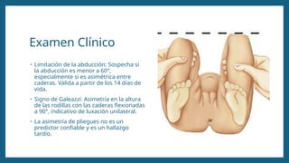 Examen Clínico
• Limitación de la abducción: Sospecha si
la abducción es menor a 60°,
especialmente si es asimétrica entre
caderas. Válida a partir de los 14 días de
vida.
• Signo de Galeazzi: Asimetría en la altura
de las rodillas con las caderas flexionadas
a 90°, indicativo de luxación unilateral.
• La asimetría de pliegues no es un
predictor confiable y es un hallazgo
tardío.
 