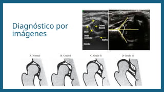 Diagnóstico por
imágenes
 