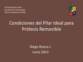 Condiciones del Pilar Ideal para
Prótesis Removible
Diego Rivera J.
Junio 2013
Universidad de Chile
Facultad de Odontología
Clínica Integral del Adulto
 