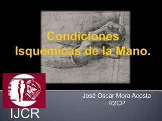 José Oscar Mora Acosta
               R2CP

IJCR
 