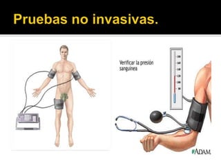    Temperatura.                    Ultrasonografía.
     Debe estar entre 20 y 30        No es un confiable.
      grados.                         Solo valora la presencia
                                       o no de flujo.
   Medida de la presión
    arterial segmentaria.           Pletismografía.
     Los cambios de 20               En este examen se
      mmHg entre puntos                compara la presión
      iguales de ambas                 sistólica entre las
      extremidades                     extremidades inferiores y
     15 mmHg entre                    superiores para ayudar a
      diferentes puntos de la          descartar alguna
      misma extremidad.                enfermedad que esté
                                       obstruyendo las arterias
                                       en las extremidades.
 