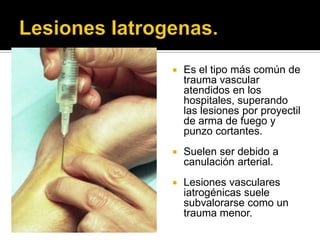    Es el tipo más común de
    trauma vascular
    atendidos en los
    hospitales, superando
    las lesiones por proyectil
    de arma de fuego y
    punzo cortantes.
   Suelen ser debido a
    canulación arterial.
   Lesiones vasculares
    iatrogénicas suele
    subvalorarse como un
    trauma menor.
 