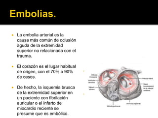    La embolia arterial es la
    causa más común de oclusión
    aguda de la extremidad
    superior no relacionada con el
    trauma.

   El corazón es el lugar habitual
    de origen, con el 70% a 90%          60% de los casos de
    de casos.                             desprendimiento de trombos
                                          murales macro embólicos se
                                          alojan en la arteria braquial.
   De hecho, la isquemia brusca
    de la extremidad superior en         Cuando son microembolias
    un paciente con fibrilación           los lugares de oclusión son los
    auricular o el infarto de             dígitos.
    miocardio reciente se
    presume que es embólico.
 