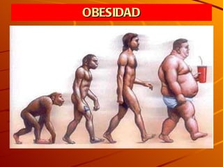 OBESIDAD 