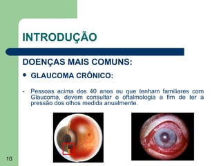INTRODUÇÃO

     DOENÇAS MAIS COMUNS:
        GLAUCOMA CRÔNICO:

     - Pessoas acima dos 40 anos ou que tenham familiares com
       Glaucoma, devem consultar o oftalmologia a fim de ter a
       pressão dos olhos medida anualmente.




10
 