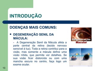 INTRODUÇÃO

     DOENÇAS MAIS COMUNS:
        DEGENERAÇÃO SENIL DA
         MÁCULA:
         - A Degeneração Senil da Mácula afeta a
         parte central da retina (tecido nervoso
         sensível à luz). Toda a retina contribui para a
         visão, mas somente a mácula define uma
         visão nítida, que permite ver detalhes. Se
         sua visão ficar distorcida ou com uma
         mancha escura no centro, faça logo um
         exame ocular.
13
 