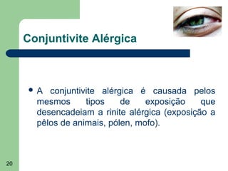 Conjuntivite Alérgica



     A   conjuntivite alérgica é causada pelos
       mesmos      tipos    de    exposição    que
       desencadeiam a rinite alérgica (exposição a
       pêlos de animais, pólen, mofo).



20
 