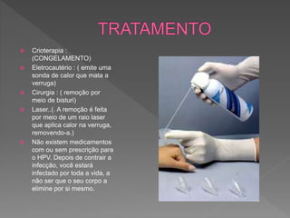  Crioterapia :
(CONGELAMENTO)
 Eletrocautério : ( emite uma
sonda de calor que mata a
verruga)
 Cirurgia : ( remoção por
meio de bisturi)
 Laser..(. A remoção é feita
por meio de um raio laser
que aplica calor na verruga,
removendo-a.)
 Não existem medicamentos
com ou sem prescrição para
o HPV. Depois de contrair a
infecção, você estará
infectado por toda a vida, a
não ser que o seu corpo a
elimine por si mesmo.
 