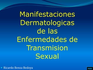 Manifestaciones
Dermatologicas
de las
Enfermedades de
Transmision
Sexual
RBB Ricardo Benza Bedoya
 